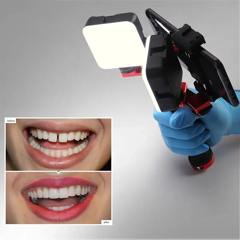 Adjustable Brightness LED Lighting Lamp Electric Powered for Dentist Oral Photography Oral Cavity Dental Surgical Instrument