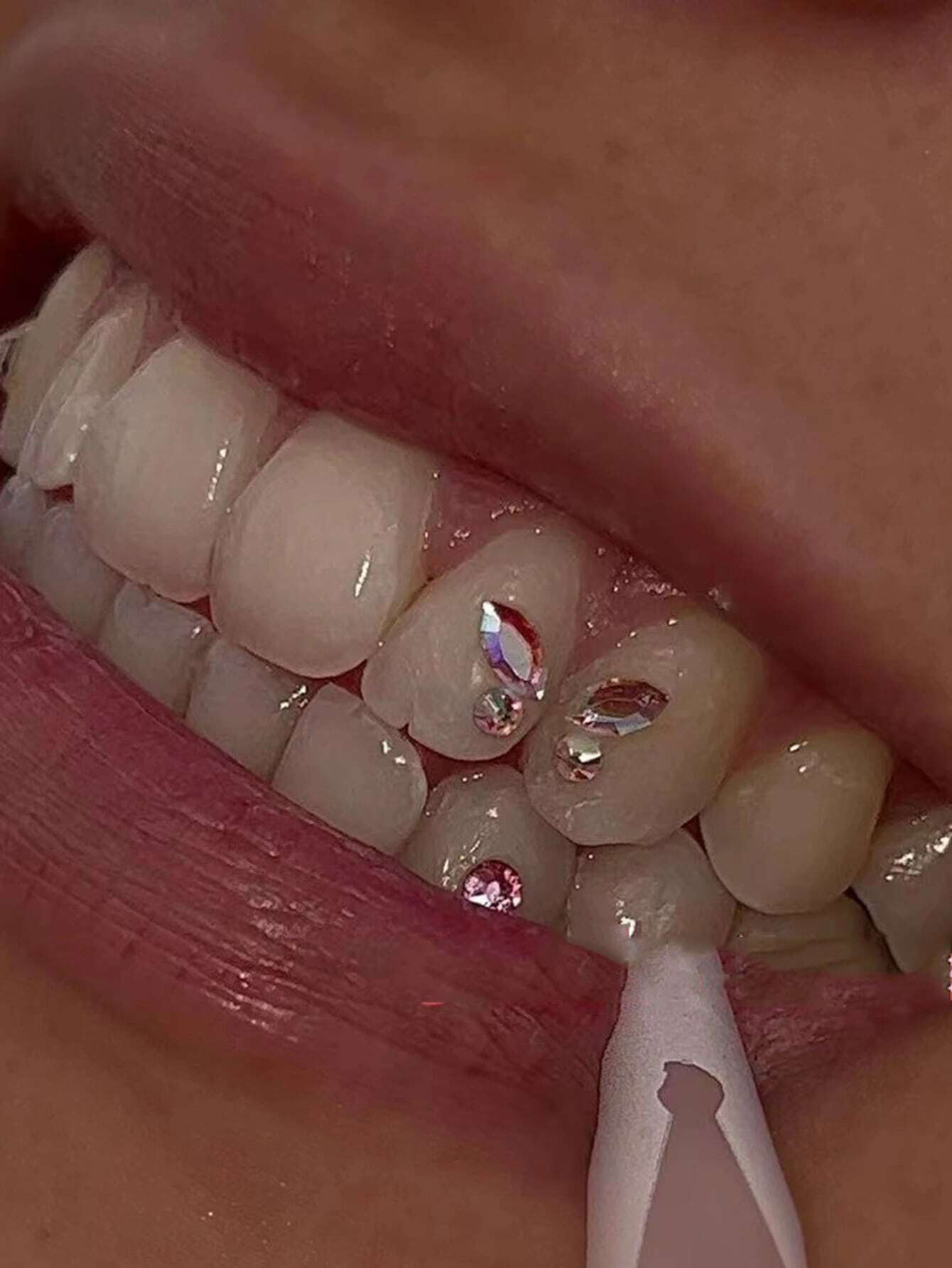 11SETS/Pack Free Shipping High Quality Crystal Tooth Crystal Tooth gems Jewelry Butterfly Teeth Gems Wholesale Tooth Gem kitems Jewelry Bear footprints Butterfly Teeth gems Wholesale Tooth gem kit