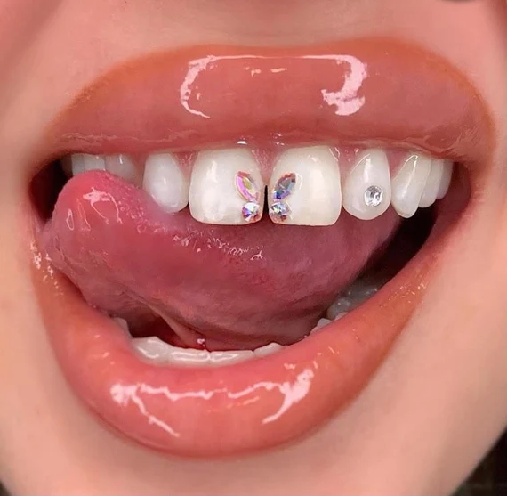 11SETS/Pack Free Shipping High Quality Crystal Tooth Crystal Tooth gems Jewelry Butterfly Teeth Gems Wholesale Tooth Gem kitems Jewelry Bear footprints Butterfly Teeth gems Wholesale Tooth gem kit
