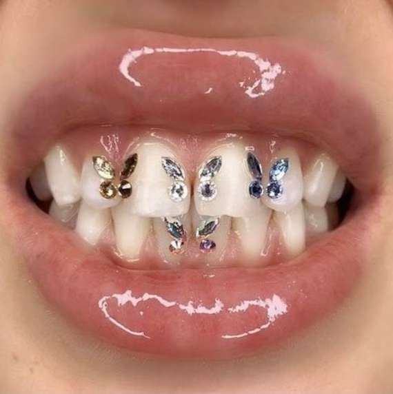 11SETS/Pack Free Shipping High Quality Crystal Tooth Crystal Tooth gems Jewelry Butterfly Teeth Gems Wholesale Tooth Gem kitems Jewelry Bear footprints Butterfly Teeth gems Wholesale Tooth gem kit