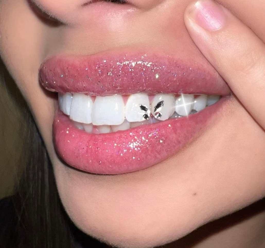 11SETS/Pack Free Shipping High Quality Crystal Tooth Crystal Tooth gems Jewelry Butterfly Teeth Gems Wholesale Tooth Gem kitems Jewelry Bear footprints Butterfly Teeth gems Wholesale Tooth gem kit