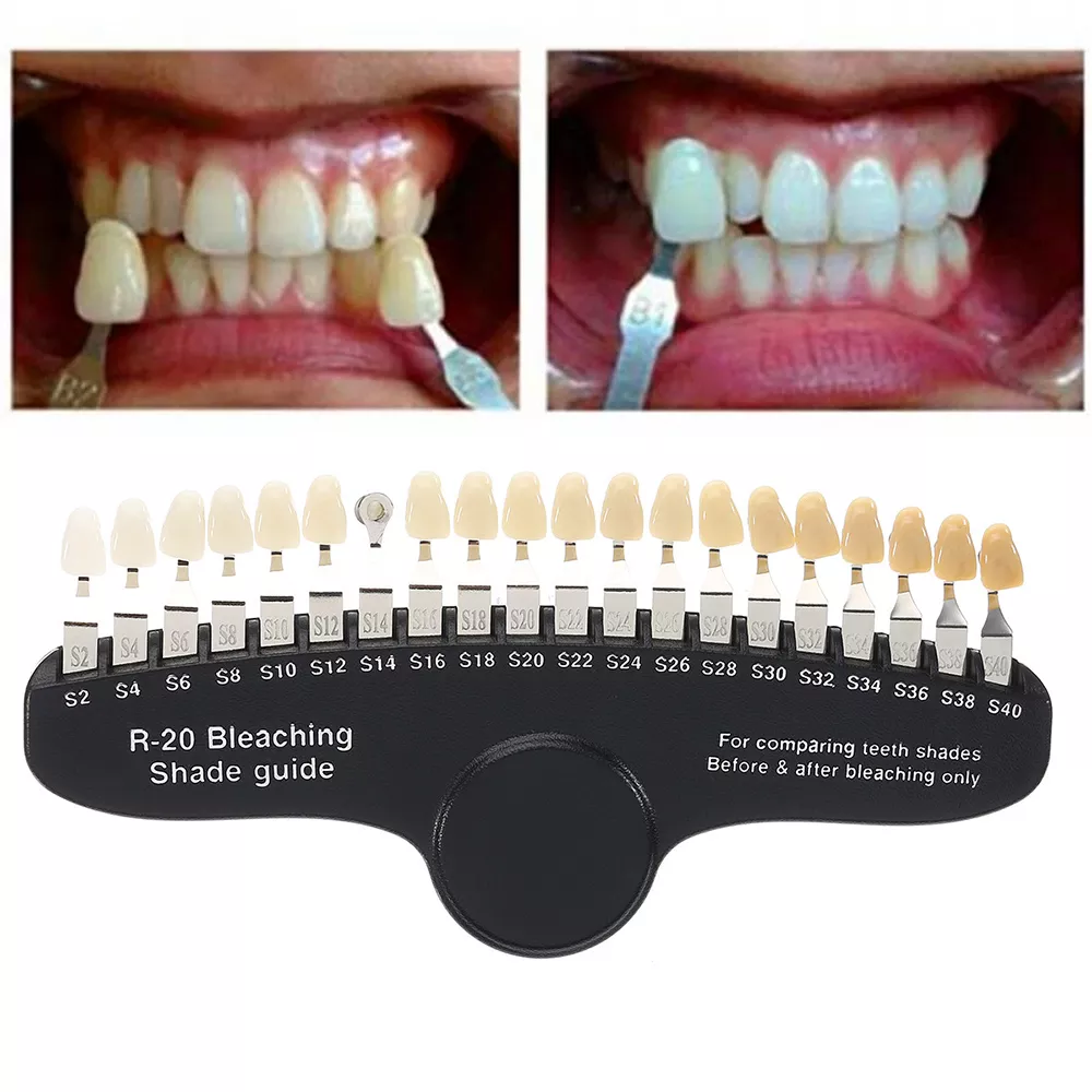 Professional 3D R-20 Teeth Whitening Shade Guide with Mirror, Classical Tooth Bleaching Shade Chart 20 Colors